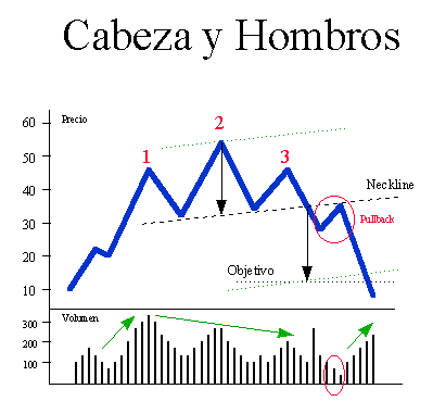 479_hombro-cabeza-hombro.gif